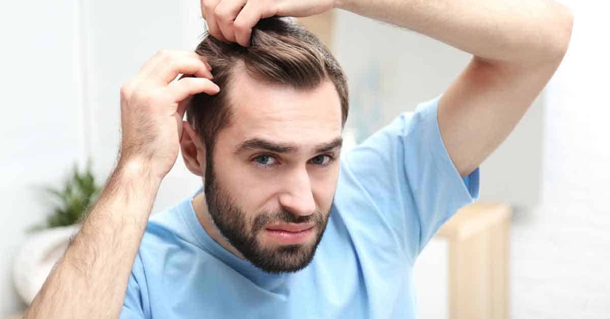 Psychology of hair loss