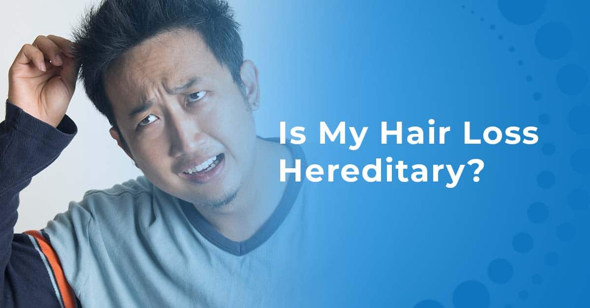 Is my hair loss hereditary?