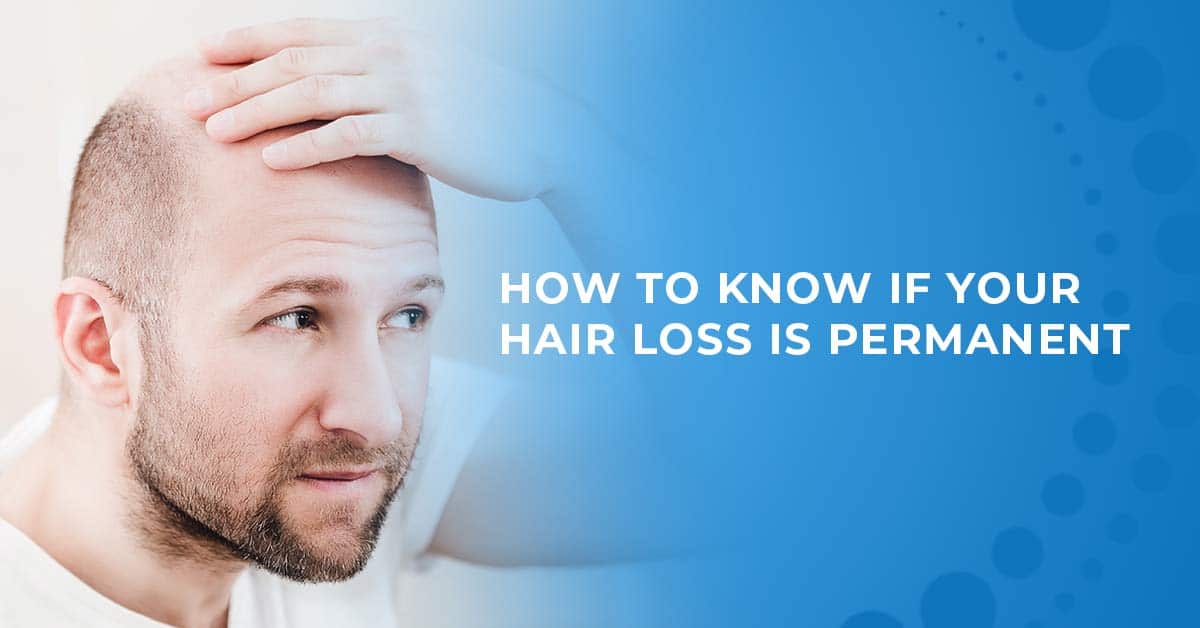 Is my hair loss permanent?